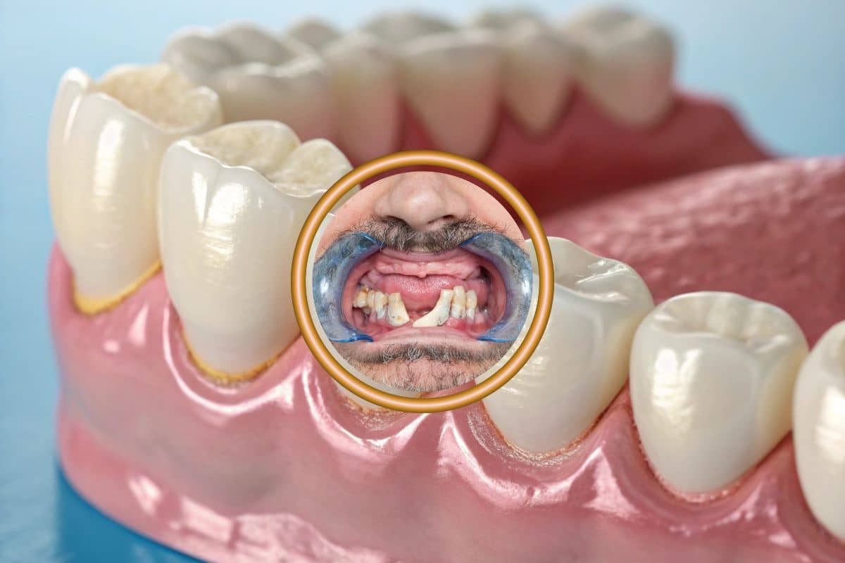 Restorative Dentistry Explained: Fillings, Implants, and Restoring Your Smile in Fort Wayne