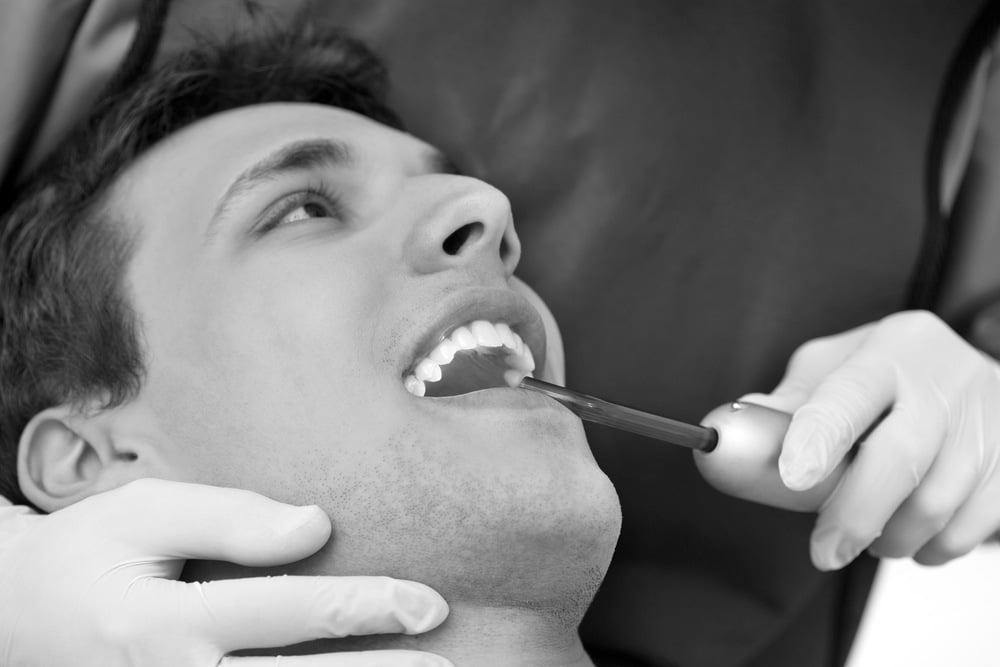 dental bonding