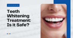 Is whitening treatment safe?