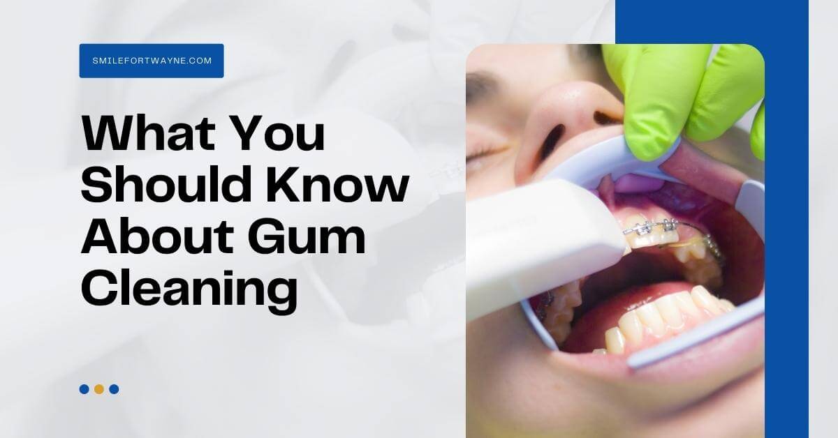 What-You-Should-Know-About-Gum-Cleaning