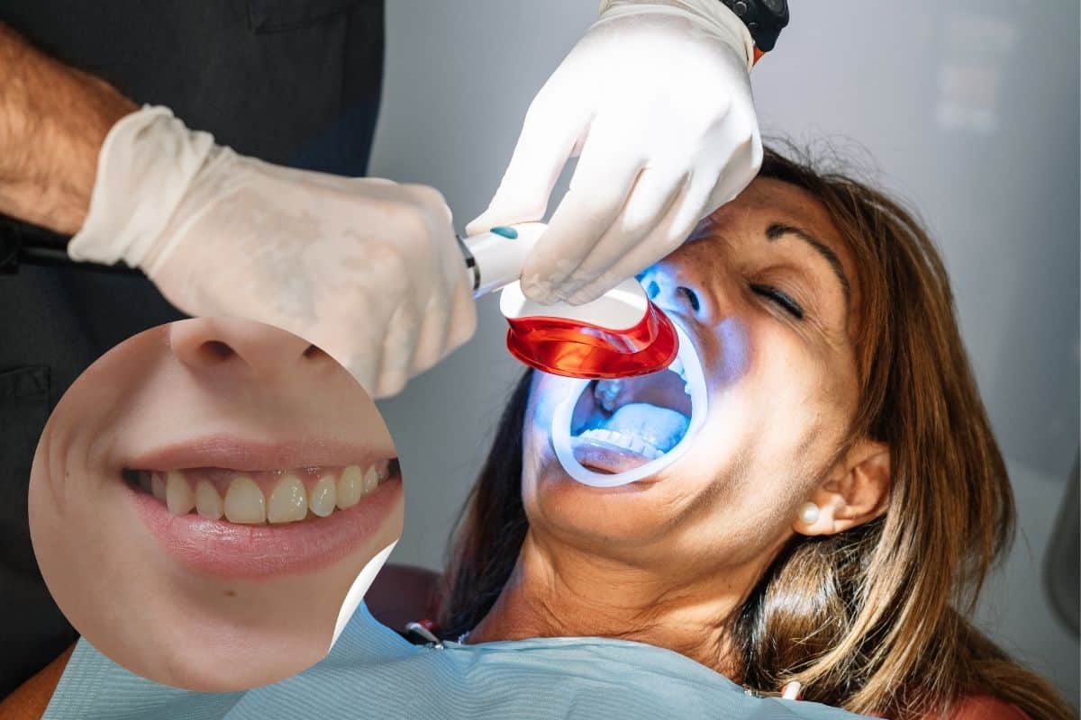 Professional Teeth Whitening in Fort Wayne IN at Family Dentistry