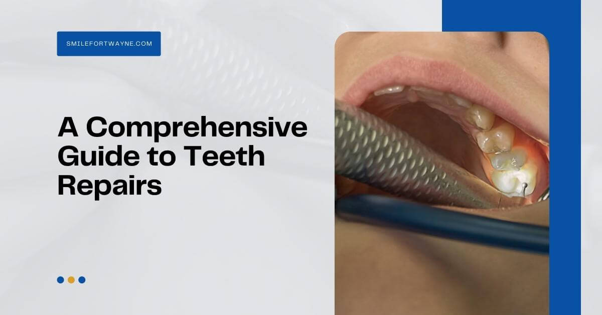 a comprehensive guifde to teeth repairs