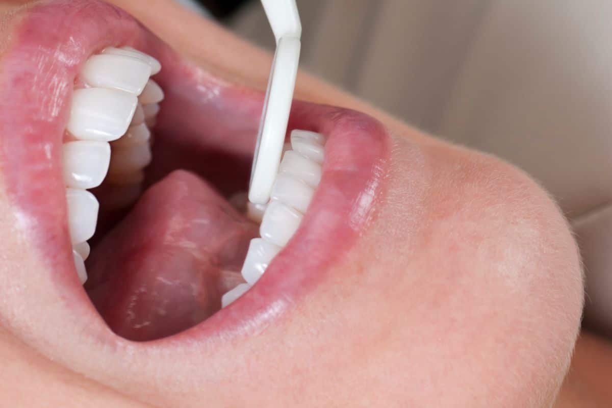 Key Differences Between Cosmetic and Restorative Dentistry - Family Dentistry & Aesthetics