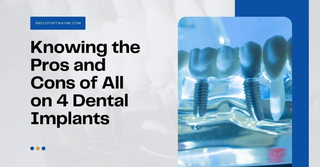 Knowing-the-Pros-and-Cons-of-All-on-4-Dental-Implants
