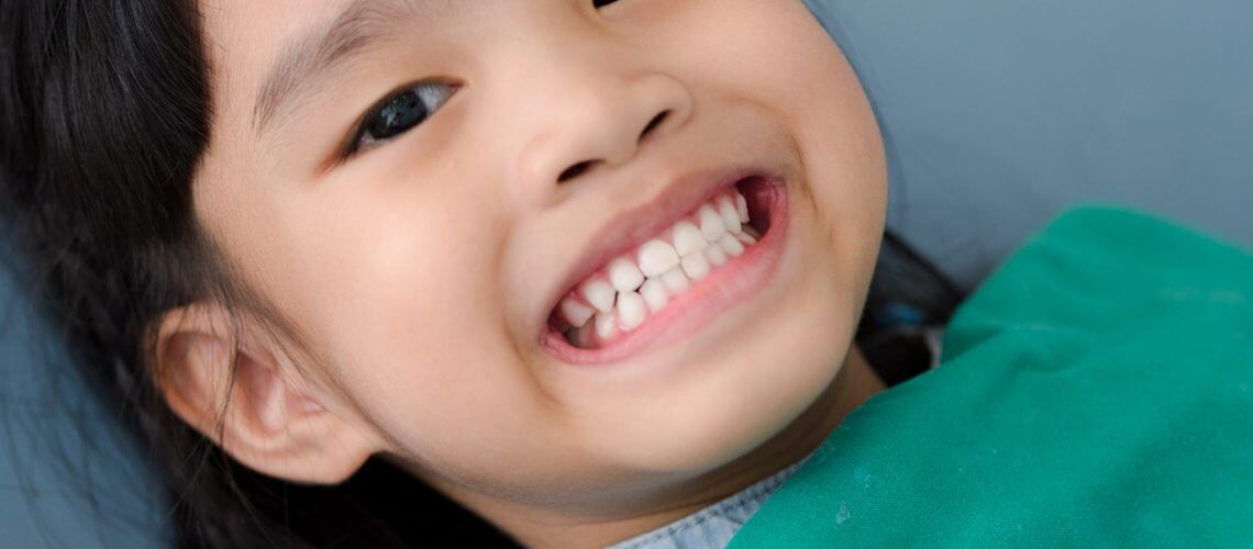 Teeth-Whitening-for-Children