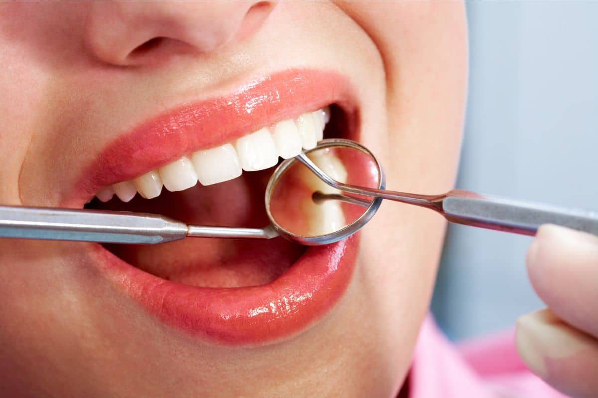 Factors drive the cost of dental bonding in Fort Wayne IN at Family Dentistry & Aesthetics, the trusted dental clinic
