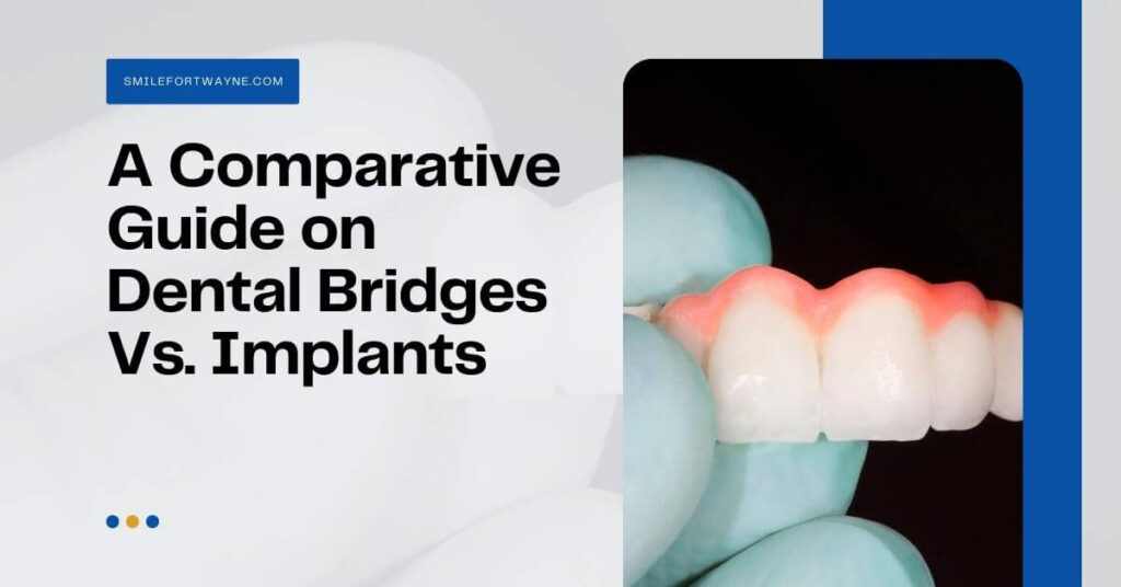A Comparative Guide on Dental Bridges Vs. Implants - Family Dentistry ...