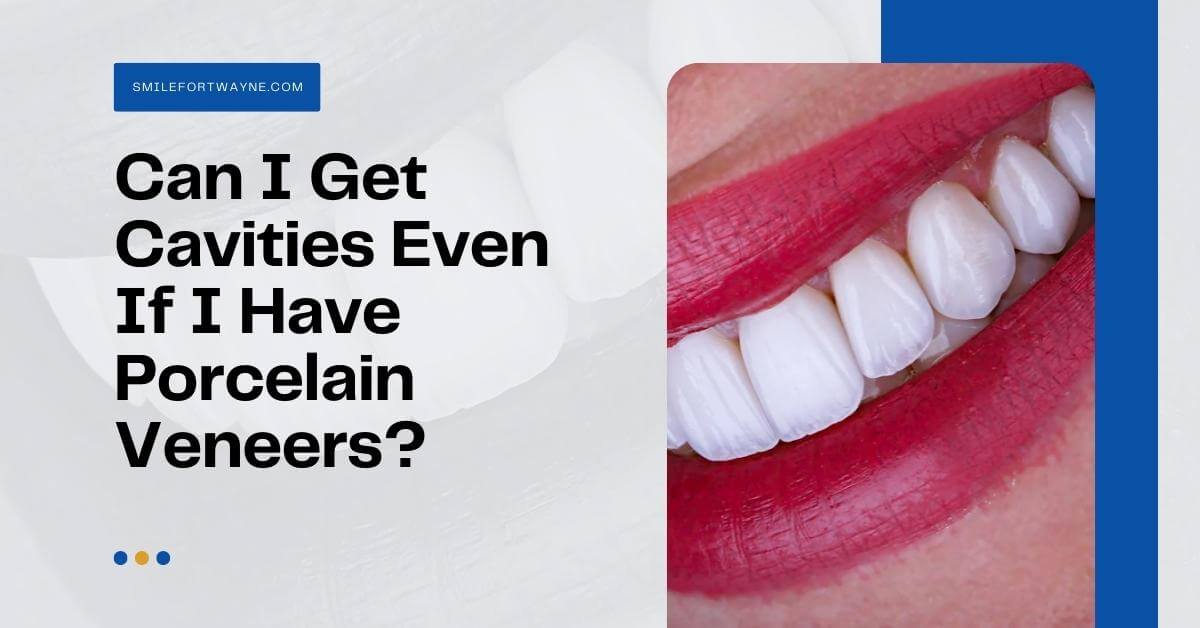 Can I Get Cavities Even If I Have Porcelain Veneers?
