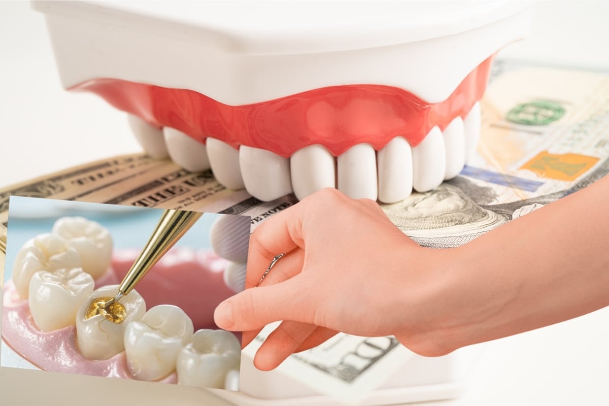 Factor That Effects on Cost of Dental Filling in Fort Wayne IN at Family Dentistry & Aesthetics