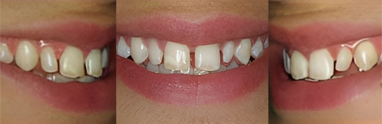 Three close-up views of patients' smiles showing dental treatment results and before/after comparisons.