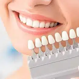 Woman smiling displaying tooth shade comparison guide for professional teeth whitening treatment.
