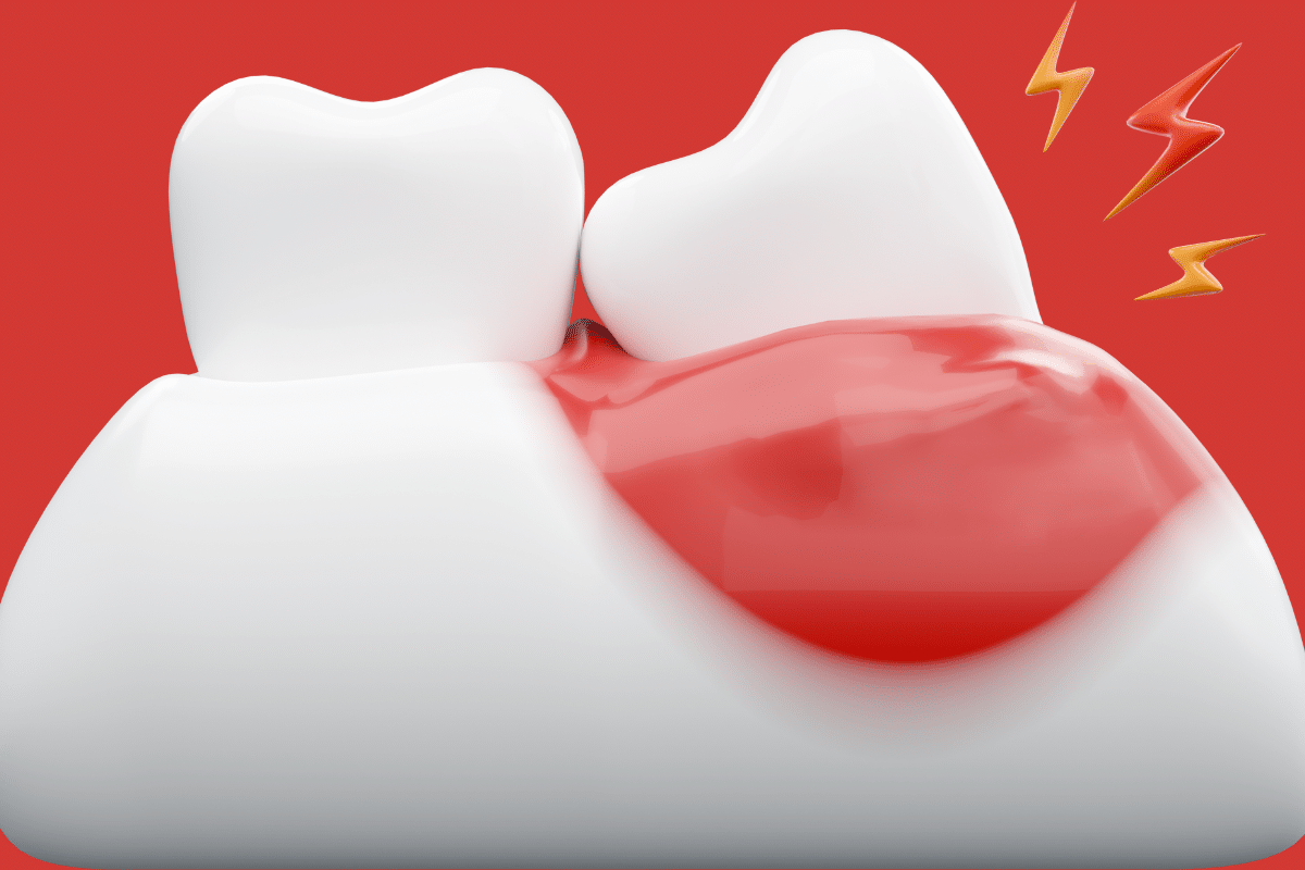 Tips to Prevent Gum Pain by Fort Worth In Dentists at Family Dentistry & Aesthetics