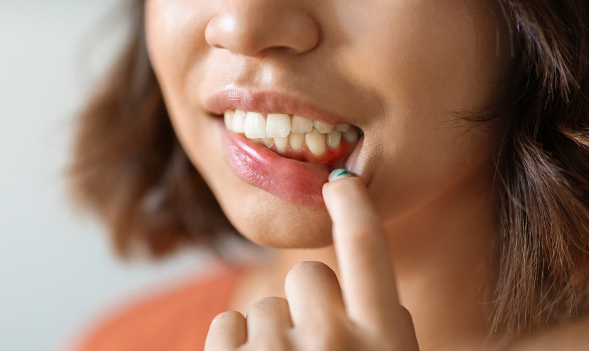 Is It Safe To Pop A Gum Abscess? Dental Experts Explain The Risks