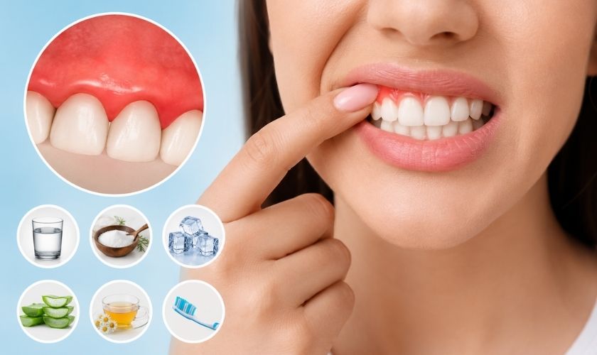 Reduce Gum Swelling